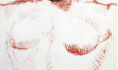 les seins de la femme à la tête rouge de Picasso, épisode sur la radiothérapie